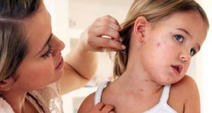 Кір: симптоми, динаміка, ускладнення хвороби