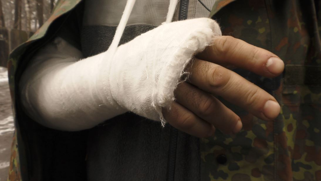 Захисники чи бандформування: в Ірпені мунвартівці зламали руку учаснику АТО